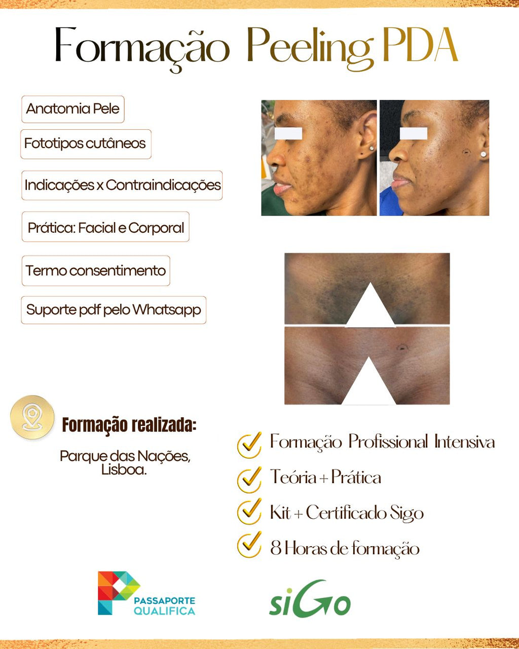 FORMAÇÃO PROFISSIONAL: PEELING PDA