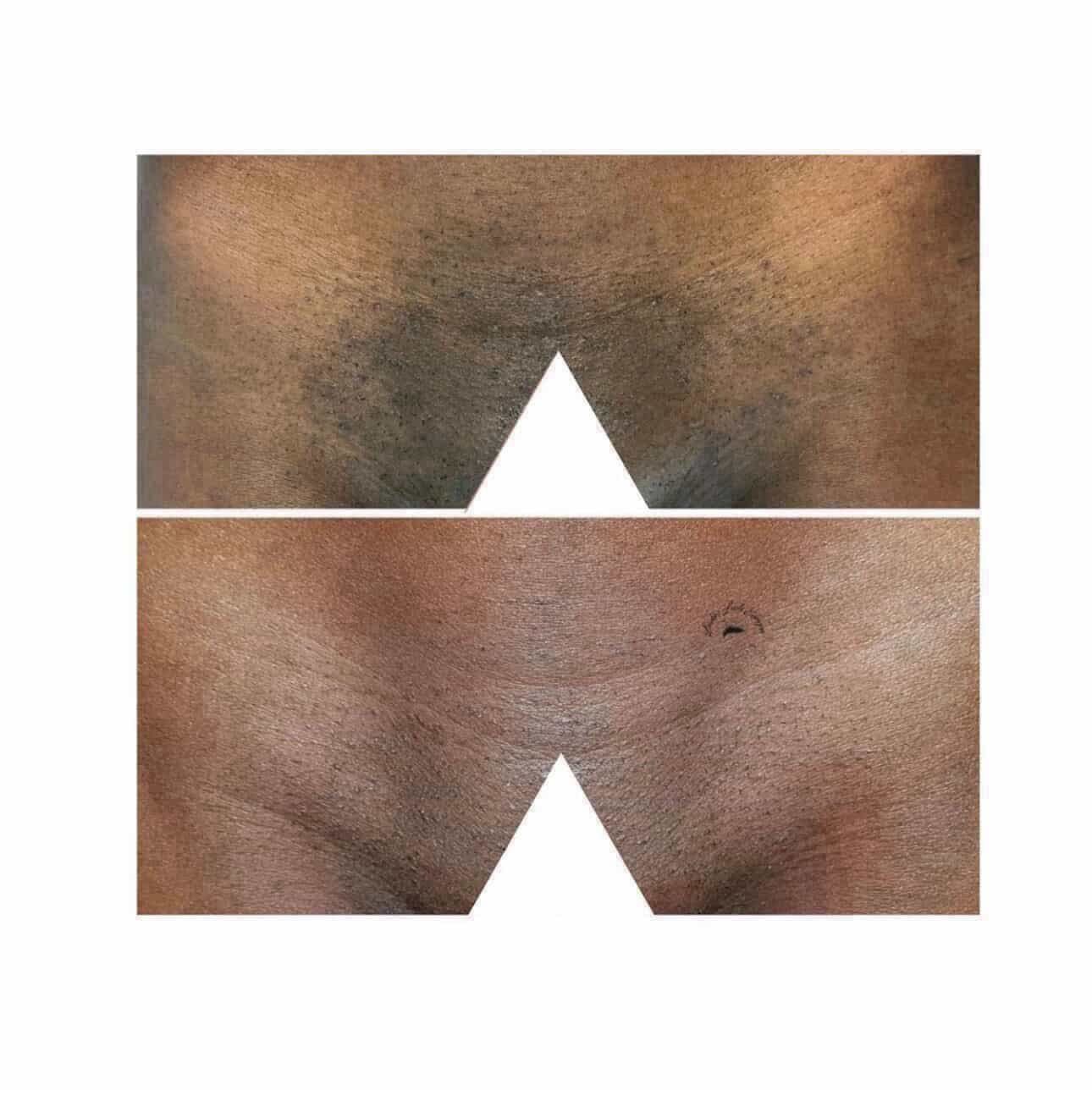 FORMAÇÃO PROFISSIONAL: PEELING PDA