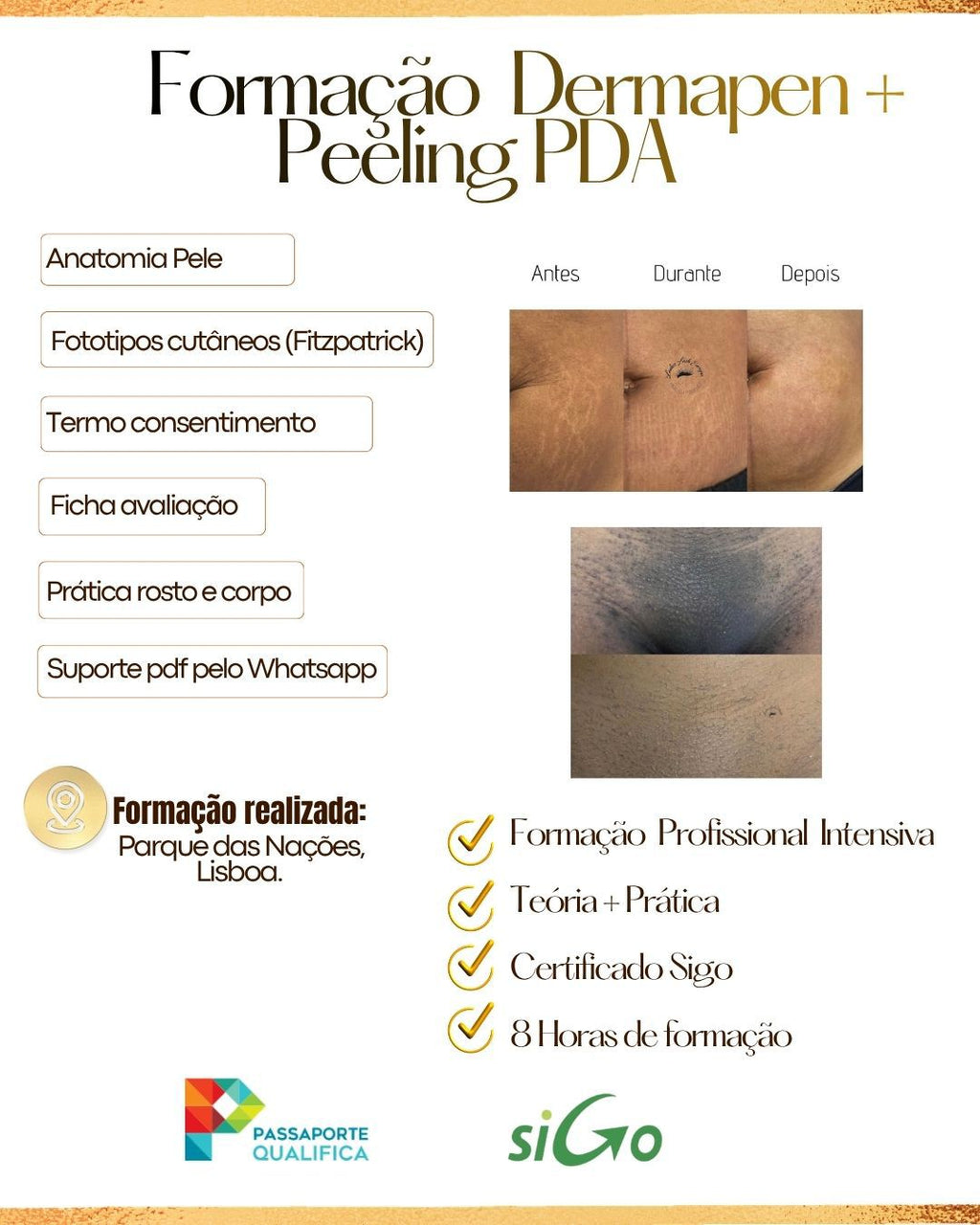 FORMAÇÃO PROFISSIONAL: PEELING PDA + DERMAPEN