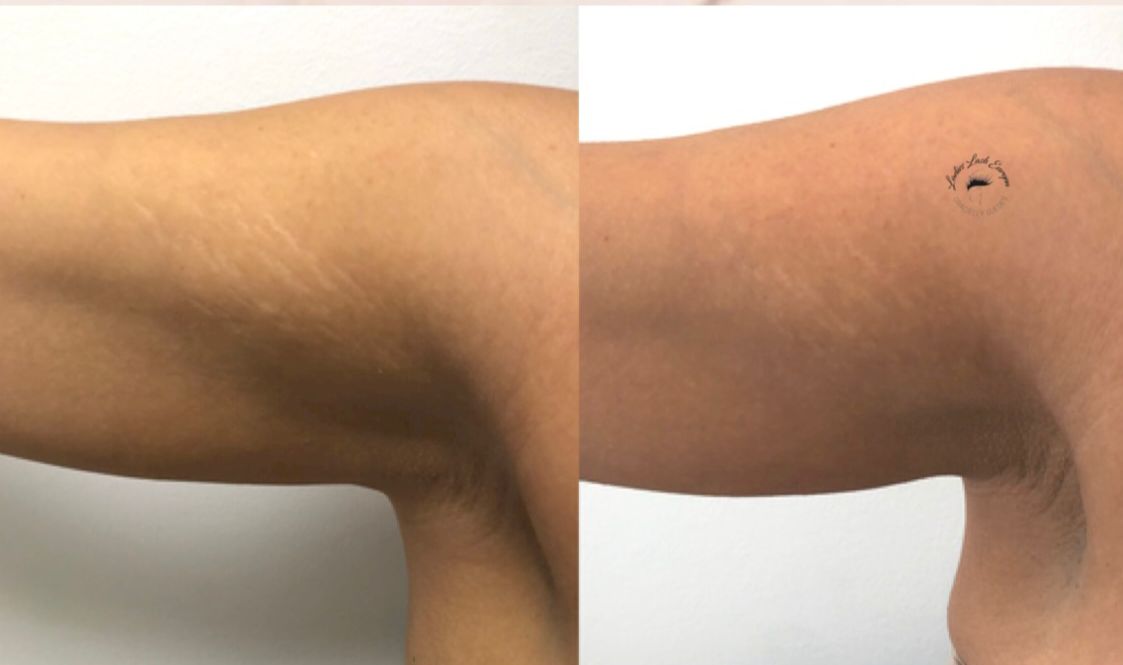 FORMAÇÃO PROFISSIONAL DERMAPEN: FACIAL E CORPORAL