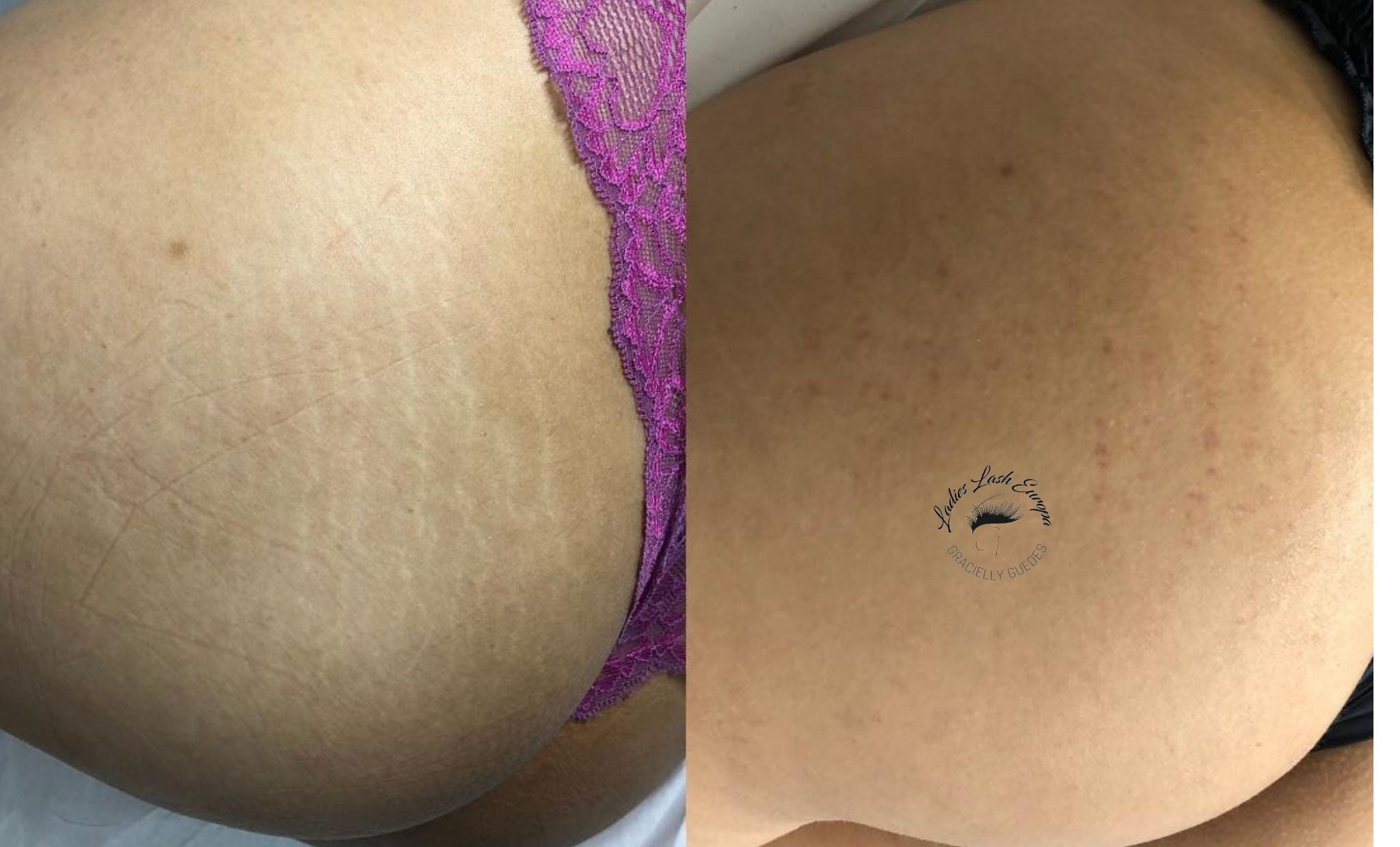 FORMAÇÃO PROFISSIONAL DERMAPEN: FACIAL E CORPORAL